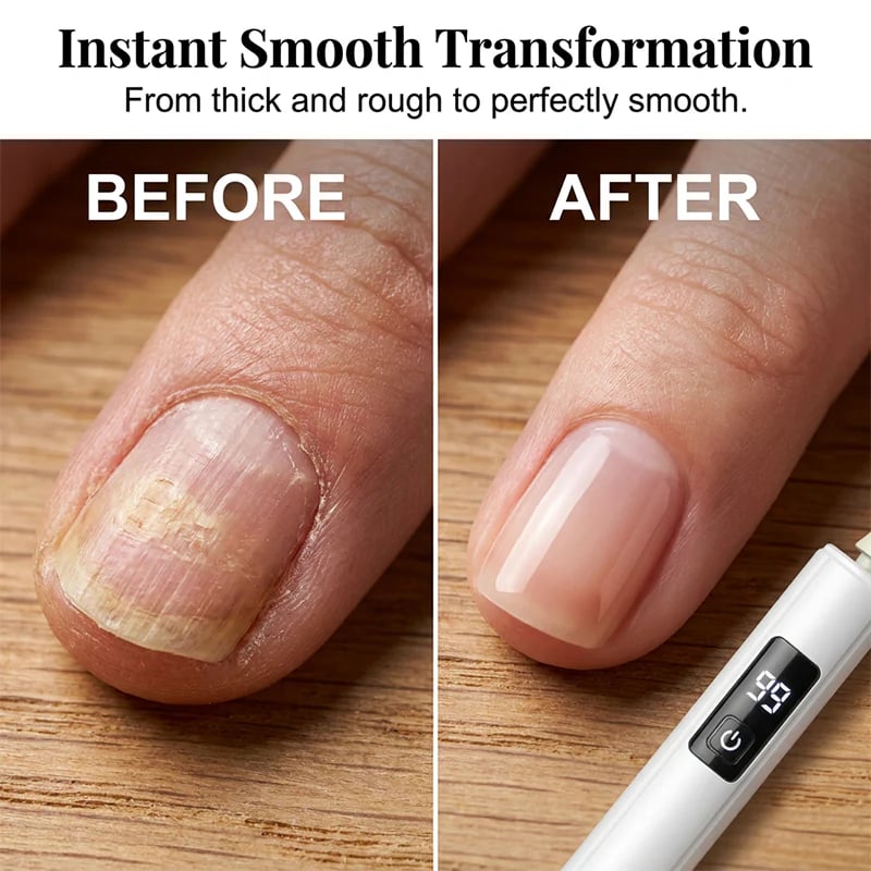 🥳2026 HOT SALE💞✨ 48% OFF! Professional Electric Nail Polisher – Smooths thick nails, 99-speed display. Multiple heads for shaping & buffing. Salon at home! 🌟💎